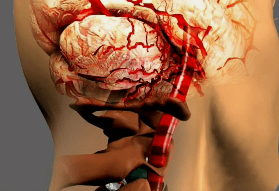 that cervical osteochondrosis is dangerous